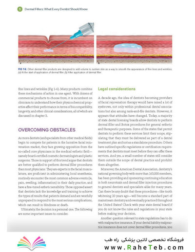 Dermal Fillers for Dental Professionals