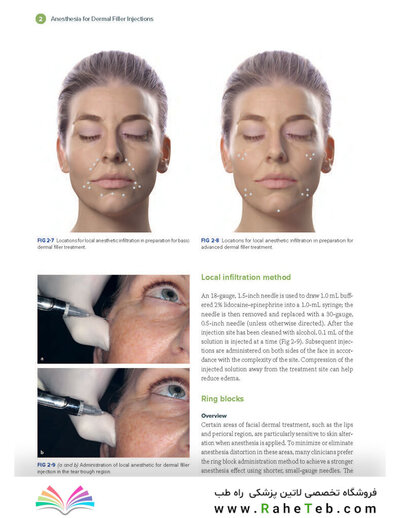Dermal Fillers for Dental Professionals