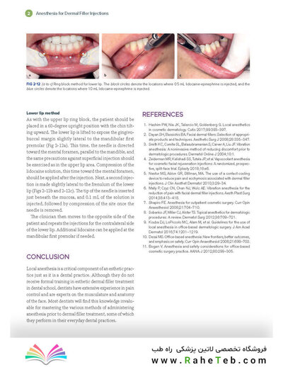 Dermal Fillers for Dental Professionals