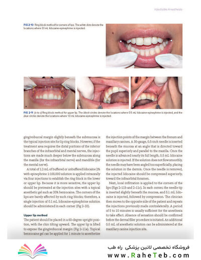 Dermal Fillers for Dental Professionals