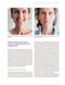Dermal Fillers for Dental Professionals