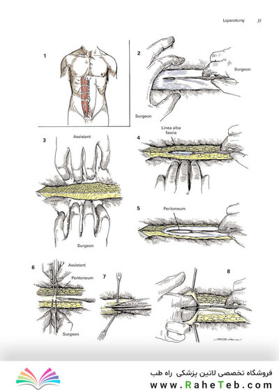 Zollinger's Atlas of Surgical Operations, Eleventh Edition 11th Edition