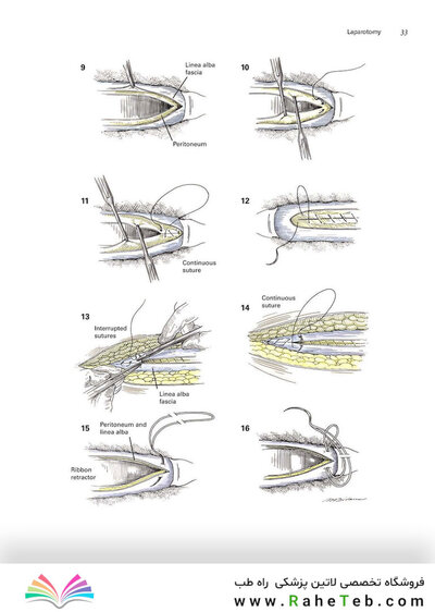 Zollinger's Atlas of Surgical Operations, Eleventh Edition 11th Edition