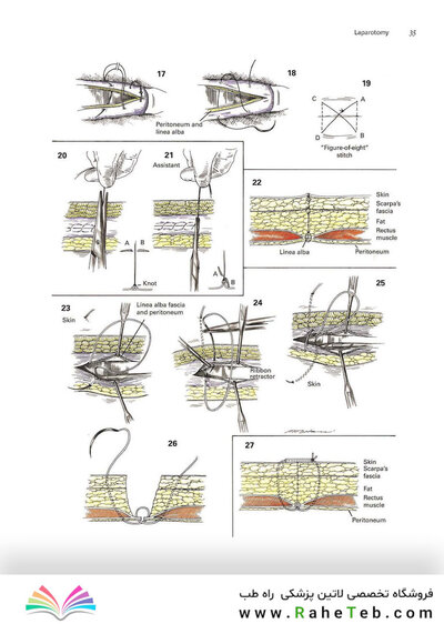 Zollinger's Atlas of Surgical Operations, Eleventh Edition 11th Edition
