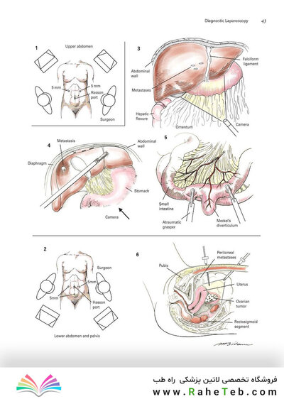 Zollinger's Atlas of Surgical Operations, Eleventh Edition 11th Edition