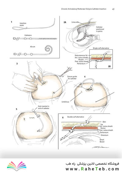 Zollinger's Atlas of Surgical Operations, Eleventh Edition 11th Edition