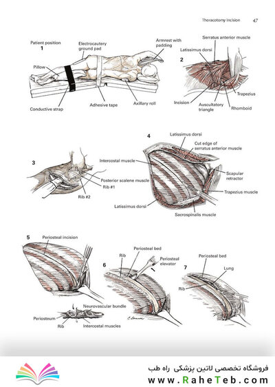 Zollinger's Atlas of Surgical Operations, Eleventh Edition 11th Edition