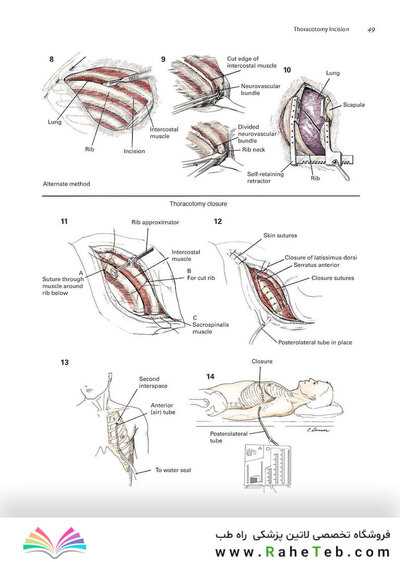 Zollinger's Atlas of Surgical Operations, Eleventh Edition 11th Edition