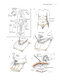 Zollinger's Atlas of Surgical Operations, Eleventh Edition 11th Edition