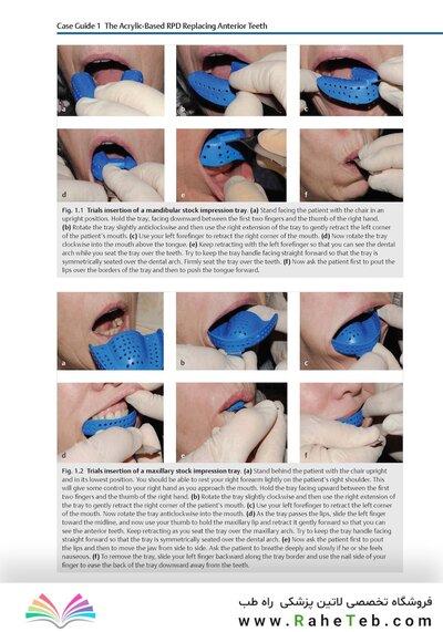 Case Guides to Complete and Partial Denture Prosthodontics 2020