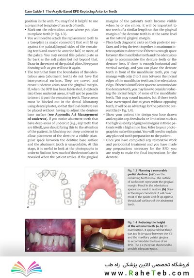Case Guides to Complete and Partial Denture Prosthodontics 2020