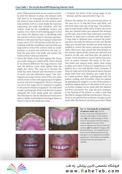 Case Guides to Complete and Partial Denture Prosthodontics 2020