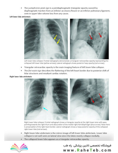 Core Radiology: A Visual Approach to Diagnostic Imaging 2nd Edición