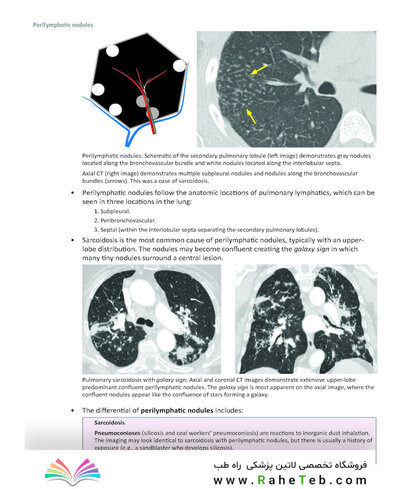 Core Radiology: A Visual Approach to Diagnostic Imaging 2nd Edición