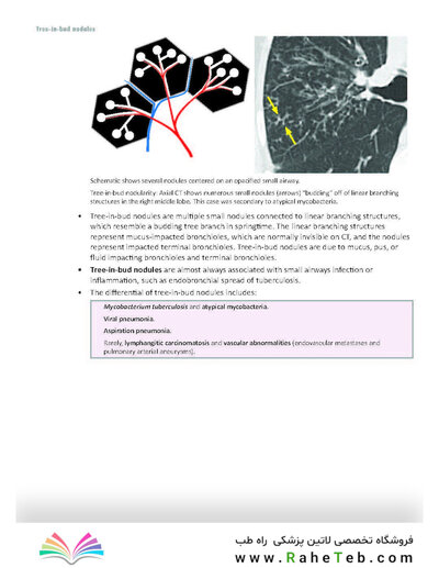 Core Radiology: A Visual Approach to Diagnostic Imaging 2nd Edición