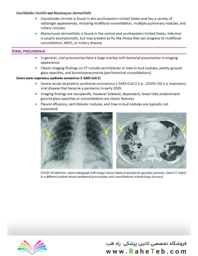 Core Radiology: A Visual Approach to Diagnostic Imaging 2nd Edicion