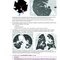 Core Radiology: A Visual Approach to Diagnostic Imaging 2nd Edición