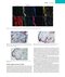 Rheumatology, 2-Volume Set 8th Edicion 2023