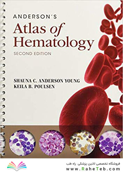 Anderson's Atlas of Hematology 2nd Edicion