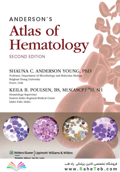 Anderson's Atlas of Hematology 2nd Edicion