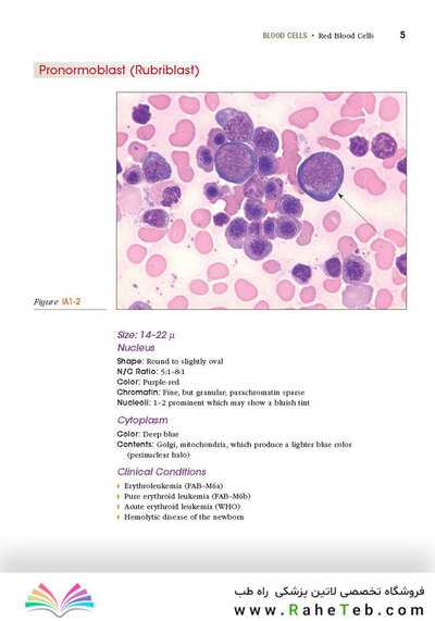 Anderson's Atlas of Hematology 2nd Edicion