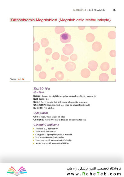 Anderson's Atlas of Hematology 2nd Edicion