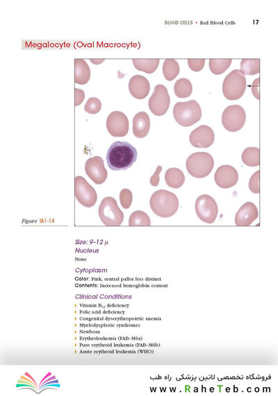 Anderson's Atlas of Hematology 2nd Edicion