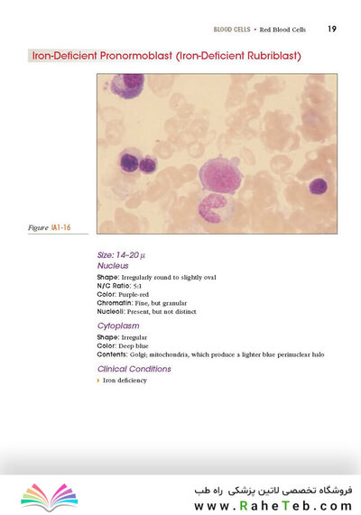 Anderson's Atlas of Hematology 2nd Edicion