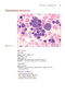Anderson's Atlas of Hematology 2nd Edicion