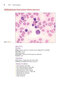 Anderson's Atlas of Hematology 2nd Edicion