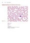 Anderson's Atlas of Hematology 2nd Edicion