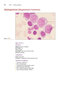 Anderson's Atlas of Hematology 2nd Edicion