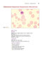 Anderson's Atlas of Hematology 2nd Edicion