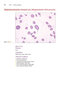 Anderson's Atlas of Hematology 2nd Edicion