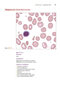 Anderson's Atlas of Hematology 2nd Edicion