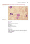Anderson's Atlas of Hematology 2nd Edicion