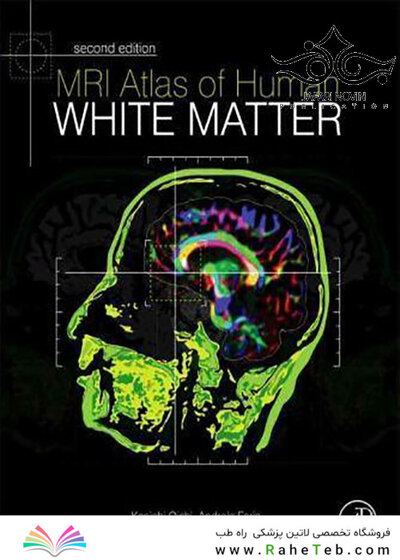 MRI Atlas of Human White Matter, 2nd Edition2010 اطلس ماده سفید انسان
