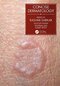 مختصر پوست Concise Dermatology, 1st Edition