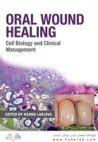 Oral Wound Healing