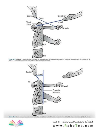 Rockwood and Green's Fractures in Adults 10th Edition 2025
