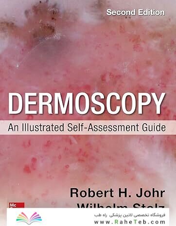 Dermoscopy: An Illustrated Self-Assessment Guide,2nd Edition