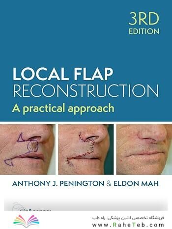 Local Flap Reconstruction, 3rd Edition