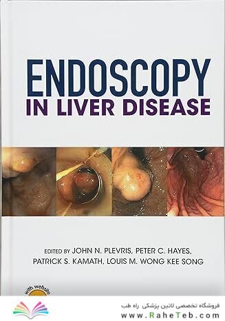Endoscopy in Liver Disease 1st Edition