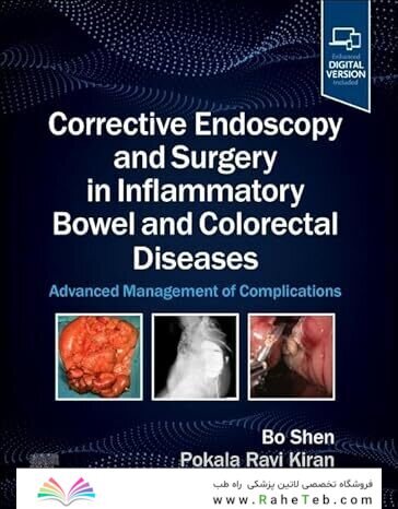 Corrective Endoscopy and Surgery in Inflammatory Bowel and Colorectal Diseases: Advanced Management of Complications