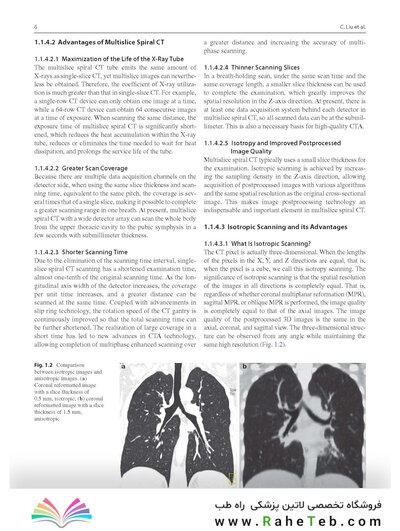 Whole Body Computed Tomography Angiography