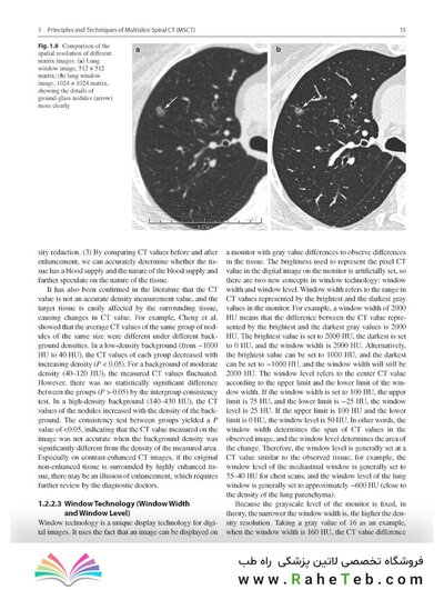 Whole Body Computed Tomography Angiography