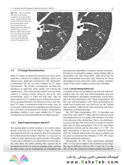Whole Body Computed Tomography Angiography