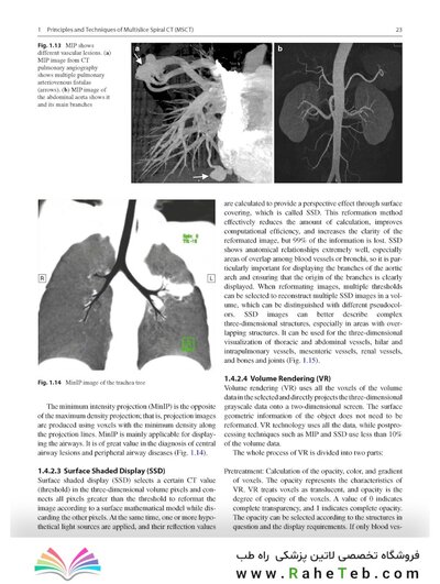 Whole Body Computed Tomography Angiography