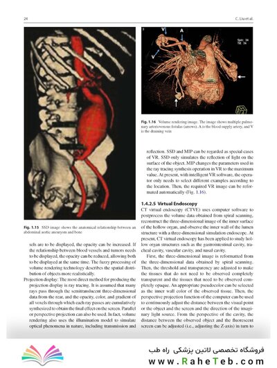 Whole Body Computed Tomography Angiography