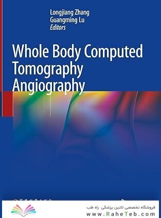 Whole Body Computed Tomography Angiography